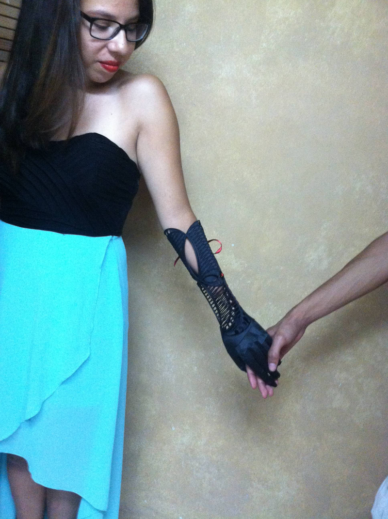 Illustration for article titled Stylish 3D-Printed Prosthetic Arm